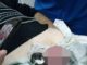 Un bărbat a ajuns la urgenţe după ce soţia i-a pus pe organul genital o piuliţă uriaşă. Operaţiunea de salvare, foarte dificilă