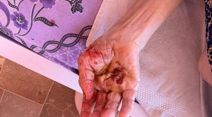 Detalii terifiante de la azilul groazei: bătrânii erau lăsați să moară în propriile excremente, bătuți și înfomentați (Video care vă poate afecta emoțional)