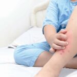 Alertă în Iași. Cazuri de malarie la copii care s-au întors recent din Africa