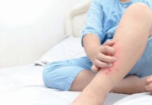 Alertă în Iași. Cazuri de malarie la copii care s-au întors recent din Africa